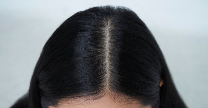 Comment améliorer le confort du cuir chevelu ?